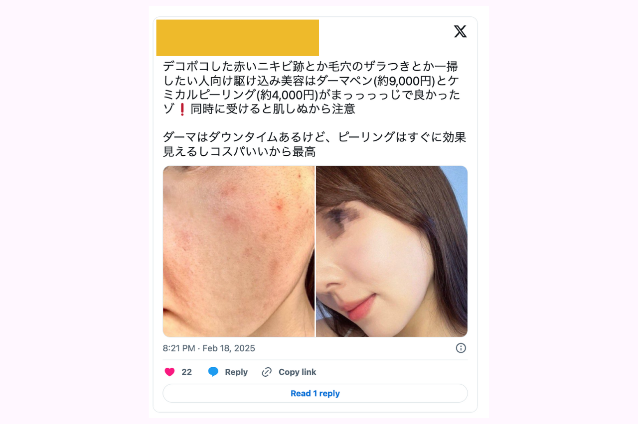 ケミカルピーリング　口コミ